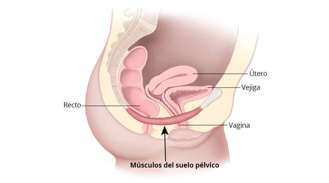 Disfunción del piso pélvico