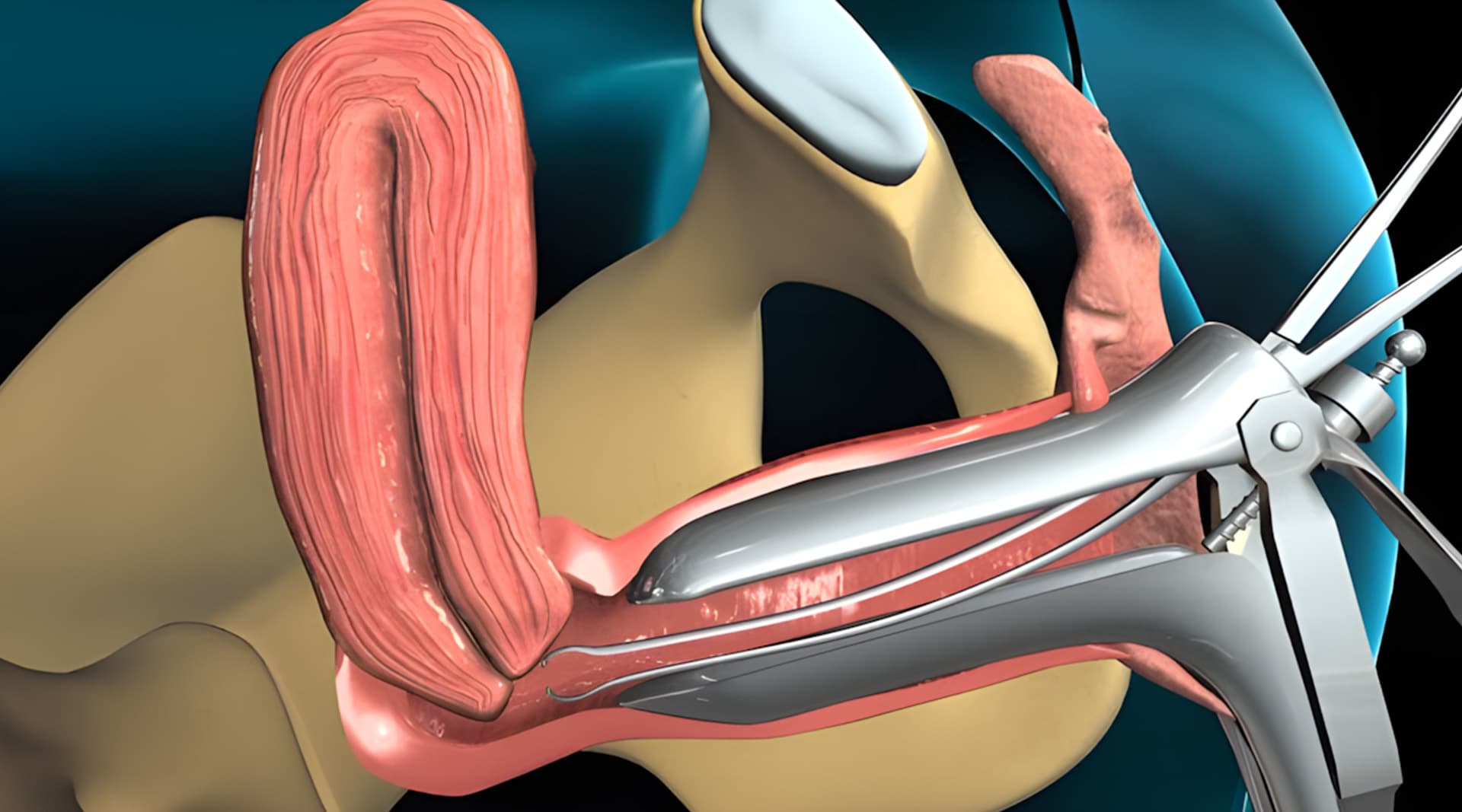 Biopsia ginecológica y transoperatoria